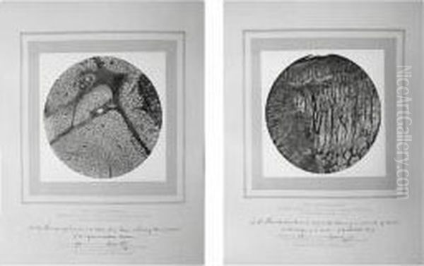 ``lecture On The Structure Of Cancerous Tumors And The Mode In Which Adjacent Parts Are Invaded' Oil Painting by Joseph Janvier Woodward