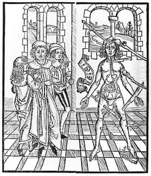 The Wounded Man Oil Painting by Hieronymus Brunschwig