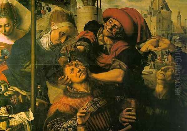 The Surgeon c. 1555 Oil Painting by Jan Sanders Van Hemessen