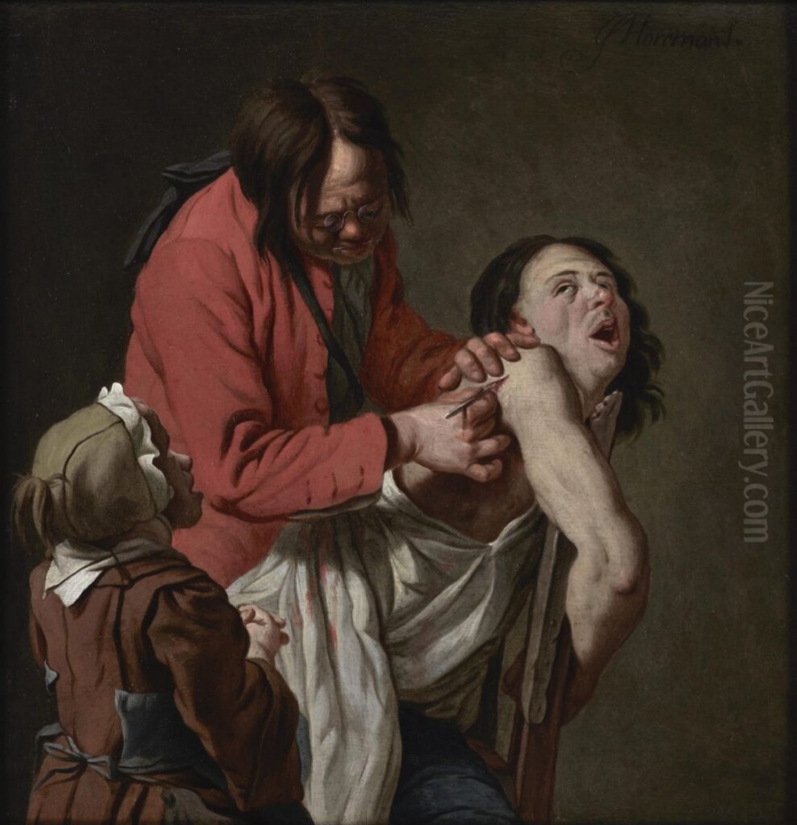 The Shoulder Operation Oil Painting by Jan Josef Horemans the Elder