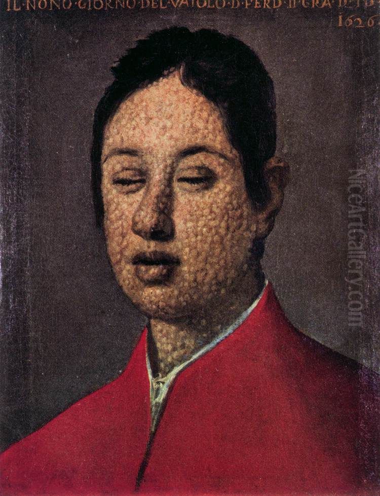 Portrait of Ferdinando II on the ninth day of smallpox Oil Painting by Justus Sustermans